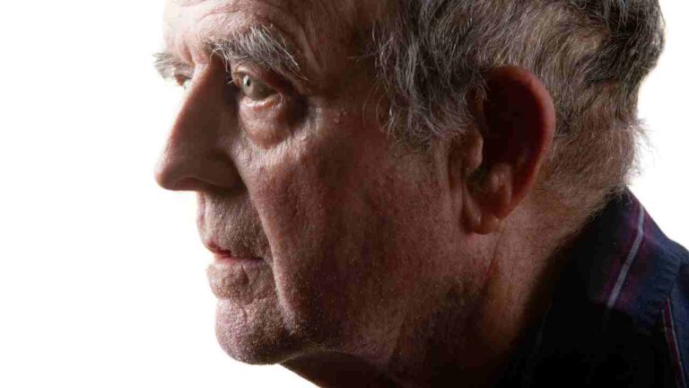 Impaired Awareness and Staring Behavior in Dementia